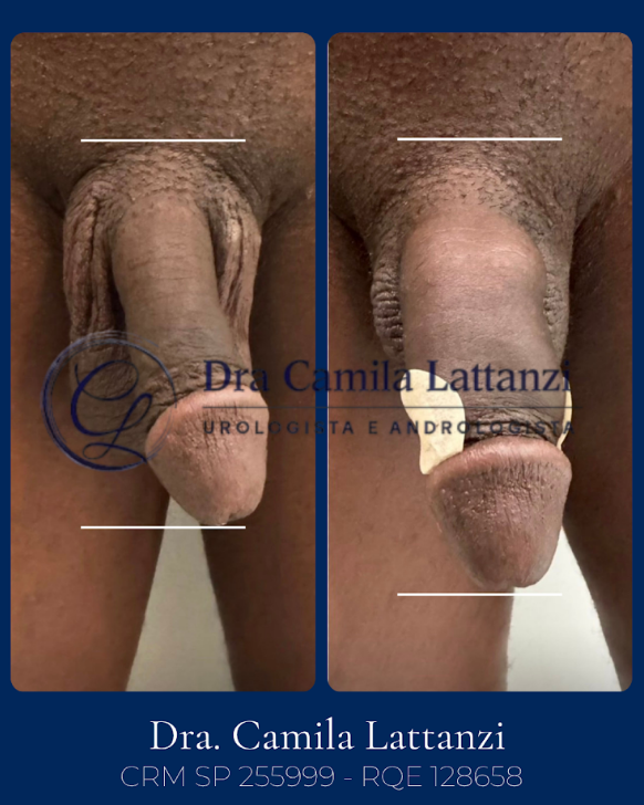 Resultado de procedimento