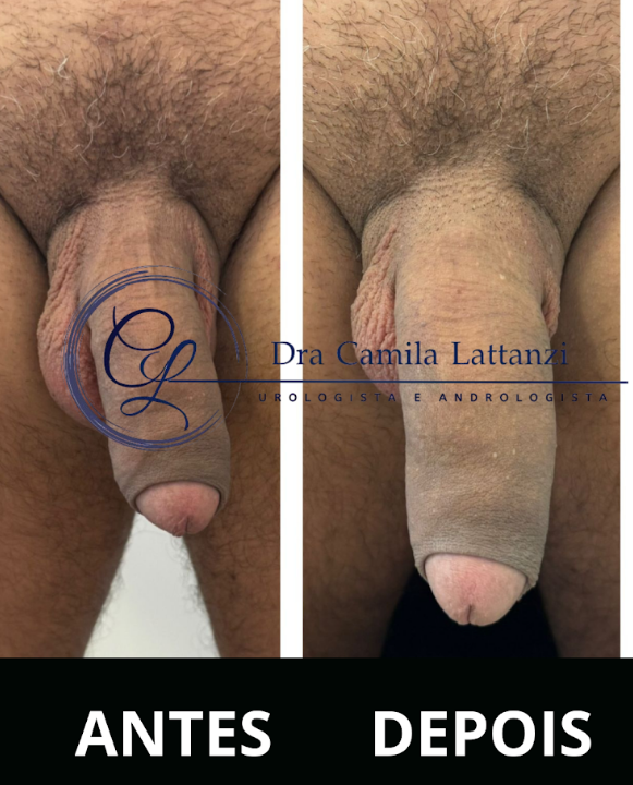 Resultado de procedimento